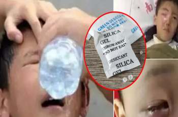 Bé trai 3 tuổi nuốt nguyên gói hút ẩm, phương pháp 60 giây của người mẹ kịp thời cứu con, bác sĩ khen ngợi