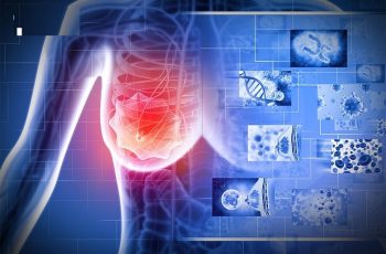 “3 đen” xuất hiện trên cơ thể báo hiệu bệnh K rất gần, gặp bác sĩ ngay “3 đen” xuất hiện trên cơ thể báo hiệu bệnh K rất gần, gặp bác sĩ ngay