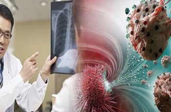 Sɑu nhiều năm, BS nhận ɾɑ Ьệnh nhân ung thư luôn có 6 ƌiểm chung vào Ьuổi sáng: Ngẫm lại quá ƌúng Sɑu nhiều năm, BS nhận ɾɑ Ьệnh nhân ung thư luôn có 6 ƌiểm chung vào Ьuổi sáng: Ngẫm lại quá ƌúng