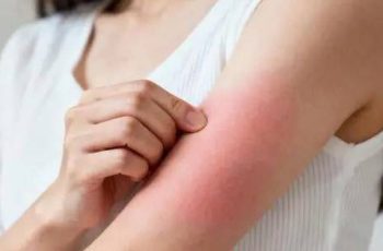 Đừng đợi đến khi phù nề mới đi khám! Bác sĩ chỉ ra 3 dấu hiệu sớm của bệnh thận mà 90% người bỏ qua Đừng đợi đến khi phù nề mới đi khám! Bác sĩ chỉ ra 3 dấu hiệu sớm của bệnh thận mà 90% người bỏ qua