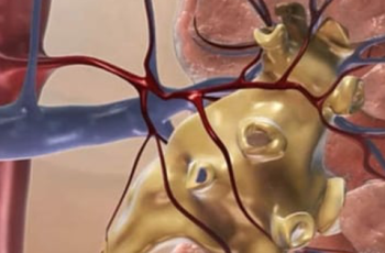 8 dấu hiệu suy thận giai đoạn đầu bạn không nên bỏ qua