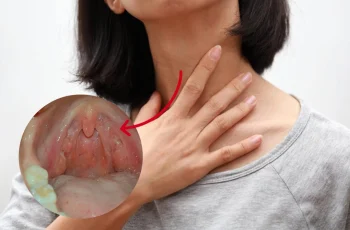 Nhiều người bị UT vòm họng nhưng cứ nghĩ là viêm amidan: BS chỉ cách phân biệt nhờ triệu chứng đi kèm