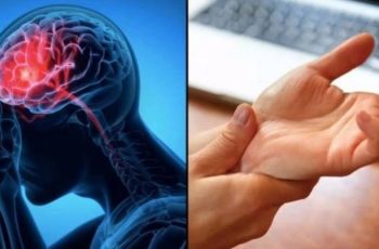 Cảnh báo đột quỵ: Dấu hiệu nhận biết trước 1 tuần, tuyệt đối không được bỏ qua