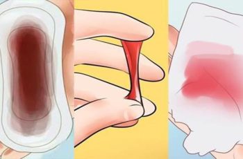 5 dấu hiệu ung thư cổ tử cung sớm nhất: 90% chị em xem thường bỏ qua