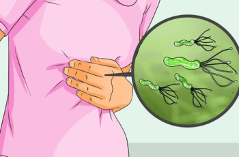 9 triệu chứng UT dạ dày giai đoạn đầu giúp phát hiện sớm bệnh