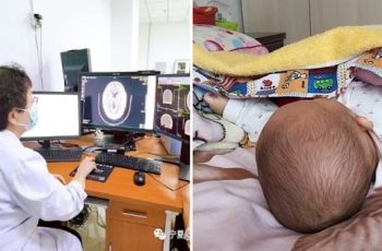 Trẻ ngủ gối và không ngủ gối có 3 điểm khác biệt khi lớn: Không chỉ IQ, cột sống cũng biến đổi bất ngờ