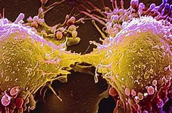 Loại rau phá hủy hơn 90% tế bào UT trong vòng 48h mà người Việt cứ ngỡ là rau dại mọc đầy đường Loại rau phá hủy hơn 90% tế bào UT trong vòng 48h mà người Việt cứ ngỡ là rau dại mọc đầy đường