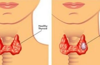 Trước khi ung thư vòm họng ‘ghé thăm’, cơ thể sẽ xuất hiện 4 vấn đề này nhưng đáng tiếc nhiều người lại bỏ qua