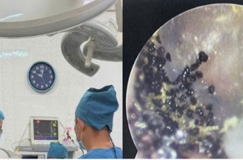 Hình ảnh từ tai em bé 7 tuổi ở Khánh Hoà khiến nhiều cha mẹ “nổi da gà”: Nuôi con không thể lơ là điều này được! Hình ảnh từ tai em bé 7 tuổi ở Khánh Hoà khiến nhiều cha mẹ “nổi da gà”: Nuôi con không thể lơ là điều này được!