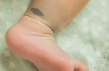 Đứa trẻ nào khi sinh ra hầu như đều có bớt trên người, nhưng nếu xuất hiện ở 10 vị trí sau báo hiệu số kiếp giàu sang Đứa trẻ nào khi sinh ra hầu như đều có bớt trên người, nhưng nếu xuất hiện ở 10 vị trí sau báo hiệu số kiếp giàu sang